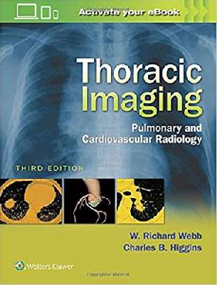 Thoracic Imaging: Pulmonary and Cardiovascular Radiology