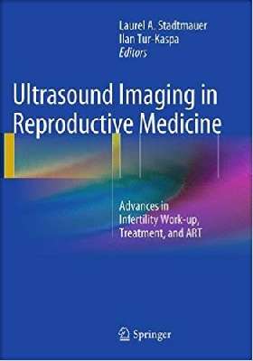 Ultrasound Imaging in Reproductive Medicine: Advances in Infertility Work-up, Treatment, and ART