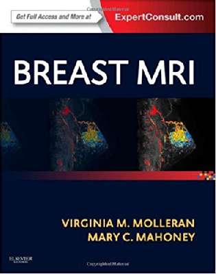 Breast MRI: Expert Consult: Online and Print, 1e