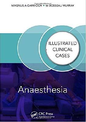 Anaesthesia: Illustrated Clinical Cases 