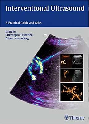 Interventional Ultrasound: A Practical Guide and Atlas