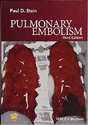 Pulmonary Embolism