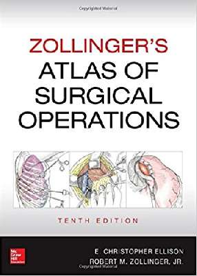 Atlas of Surgical Operations-Zollinger`s