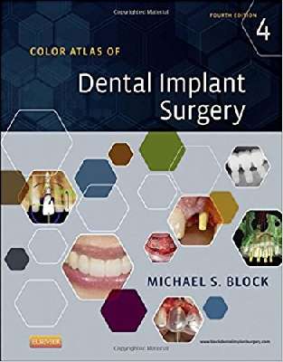 Color Atlas of Dental Implant Surgery