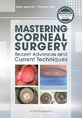 Mastering Corneal Surgery