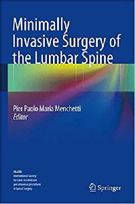 Minimally Invasive Surgery of the Lumbar Spine