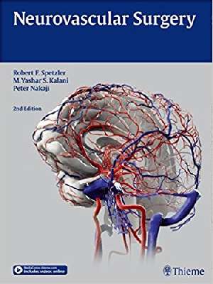 Neurovascular Surgery