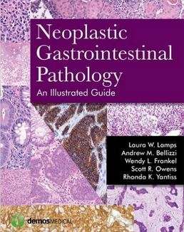 Neoplastic Gastrointestinal Pathology