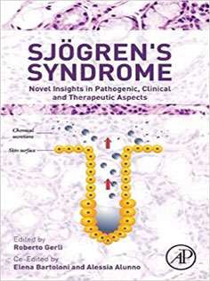 Sjogren's Syndrome