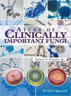 Atlas of Clinically Important Fungi