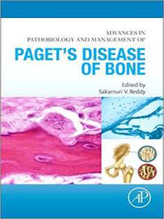 Advances in Pathobiology and Management of Paget's Disease of Bone