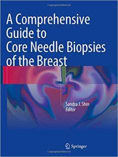 A Comprehensive Guide to Core Needle Biopsies of the Breast