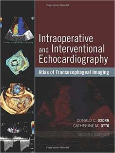 Intraoperative and Interventional Echocardiography