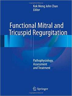 Functional Mitral and Tricuspid Regurgitation