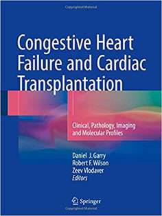 Congestive Heart Failure and Cardiac Transplantation