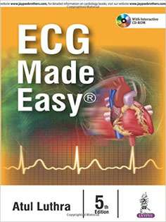 ECG Made Easy