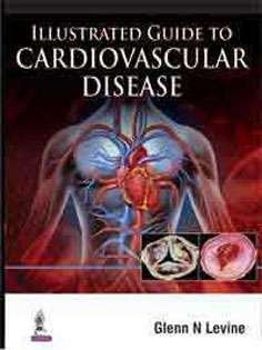 Illustrated Guide to Cardiovascular Disease