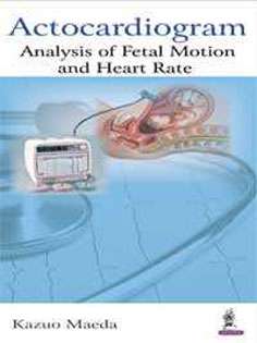 Actocardiogram: Analysis of Fetal Motion and Heart Rate