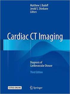 Cardiac CT Imaging: Diagnosis of Cardiovascular Disease