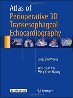 Atlas of Perioperative 3D Transesophageal Echocardiography
