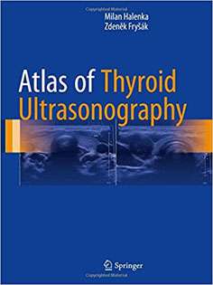 Atlas of Thyroid Ultrasonography