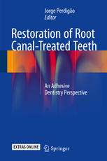 Restoration of Root Canal-Treated Teeth: An Adhesive Dentistry Perspective