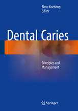 Dental Caries: Principles and Management