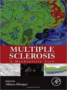 Multiple Sclerosis: A Mechanistic View