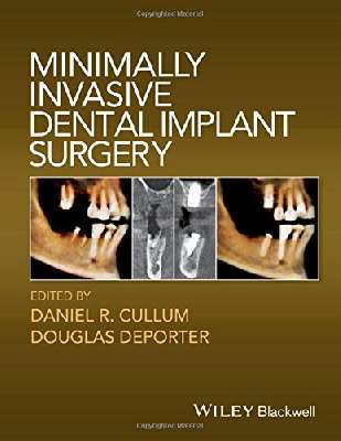 Minimally invasive dental implant surgery