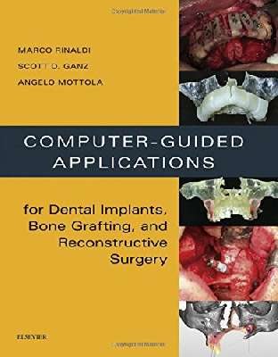 Computer-Guided Applications for Dental Implants, Bone Grafting, and Reconstructive Surgery