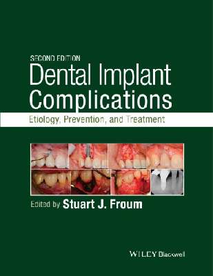 Dental implant complications