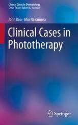 Clinical Cases in Phototherapy