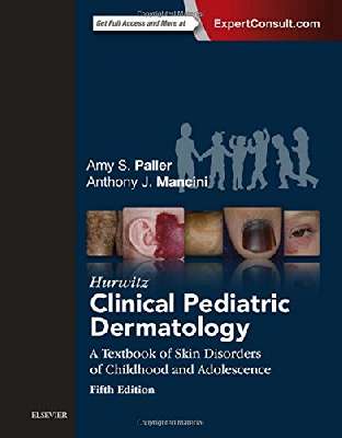 Hurwitz Clinical Pediatric Dermatology: A Textbook of Skin Disorders of Childhood and Adolescence