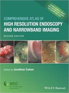 Comprehensive Atlas of High Resolution Endoscopy and Narrowband Imaging