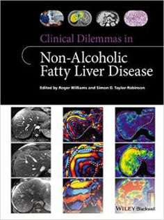 Clinical Dilemmas in Non-Alcoholic Fatty Liver Disease-Clinical Dilemmas
