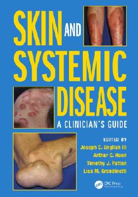 Skin and Systemic Disease : a Clinician's Guide