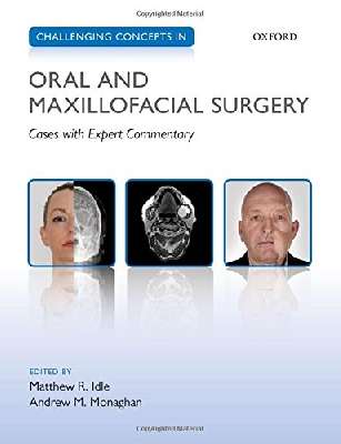 Challenging Concepts in Oral and Maxillofacial Surgery: Cases with Expert Commentary