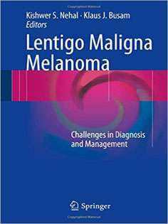 Lentigo Maligna Melanoma