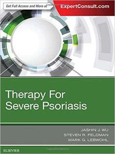 Therapy for Severe Psoriasis