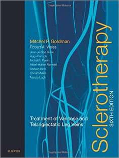 Sclerotherapy: Treatment of Varicose and Telangiectatic Leg Veins