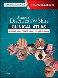 Andrews' Diseases of the Skin Clinical Atlas