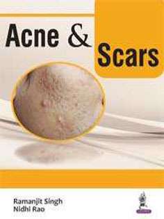 Acne & Scars