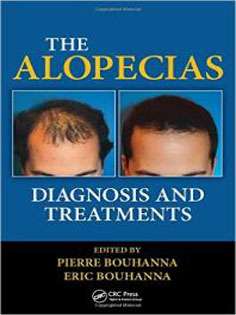 The Alopecias: Diagnosis and Treatments