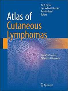 Atlas of Cutaneous Lymphomas: Classification and Differential Diagnosis