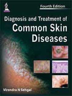 Diagnosis and Treatment of Common Skin Diseases