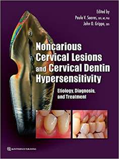 Noncarious Cervical Lesions and Cervical Dentin Hypersensitivity