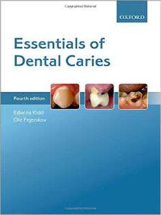 Essentials of Dental Caries