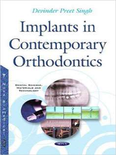 Implants in Contemporary Orthodontics