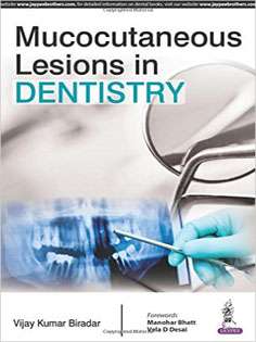 Mucocutaneous Lesions in Dentistry