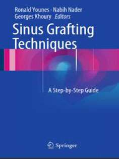 Sinus Grafting Techniques: A Step-by-Step Guide